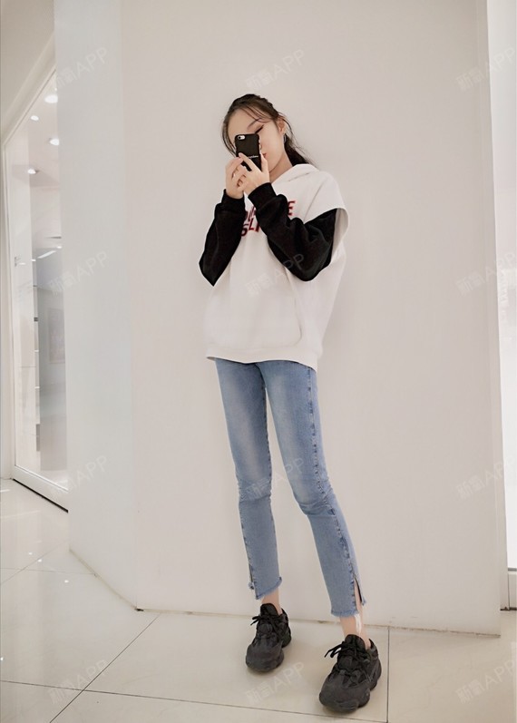 打卡签到,今天是术后一个半月的日子,腿已经完全没问_圈子-新氧美容