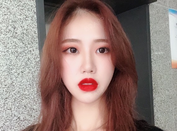 都说厚唇女孩儿很性感,可是如果嘴唇太厚了那就适得其_圈子-新氧美容