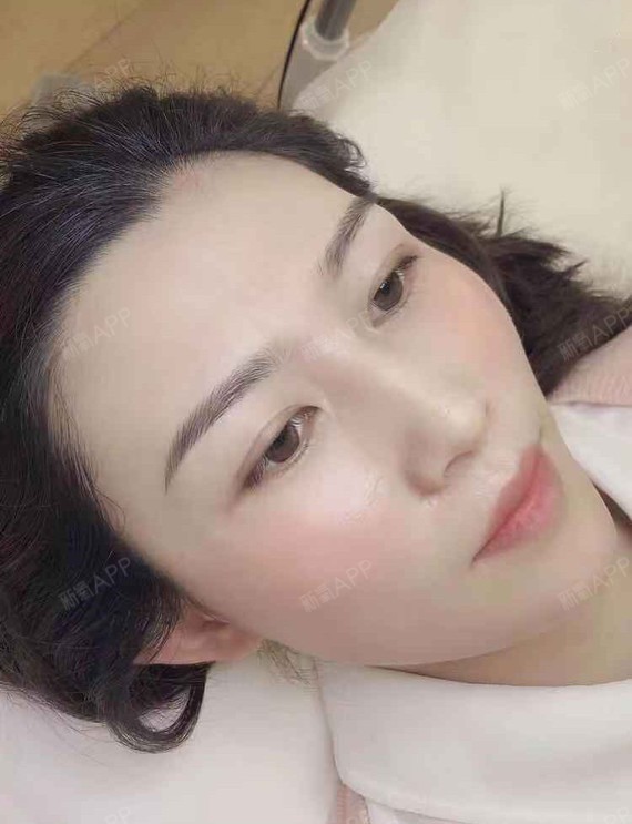 上海半永久纹眉好不好_效果图_山坡上的小狐狸半永久纹眉术后第1天