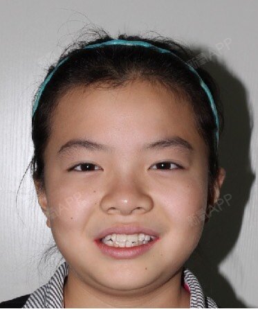 1今年15岁上初中的年纪,不说变美了看上去顺眼多了.