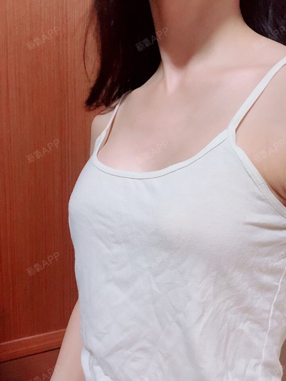 小情绪作祟l假体隆胸第25天美丽日记