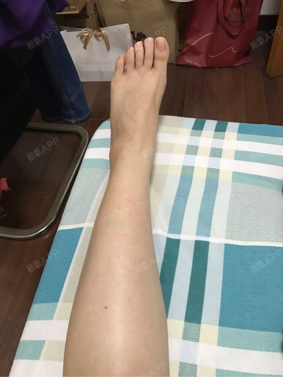 小腿有红点点,但不痒不痛,只有几根毛发有些冒头