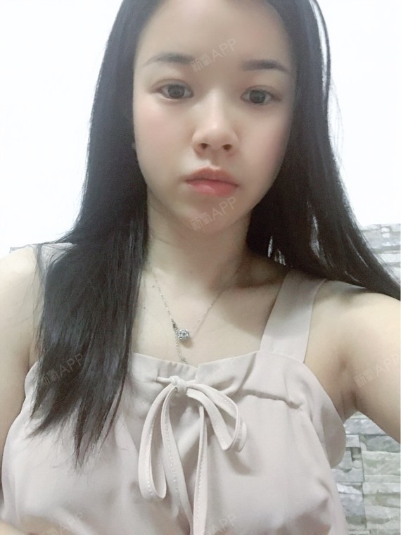 现在胸变得很软了,刚出手术的时候是左边大一点,恢复_圈子-新氧美容