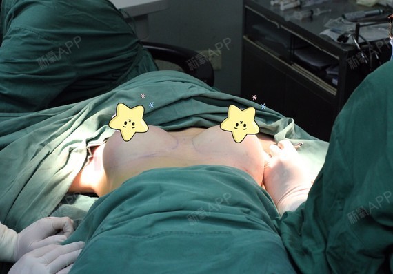 假体隆胸后起床姿势图片