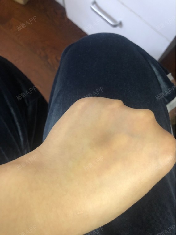 第四次两只手都打淤血了一个青一个黑吐了一次