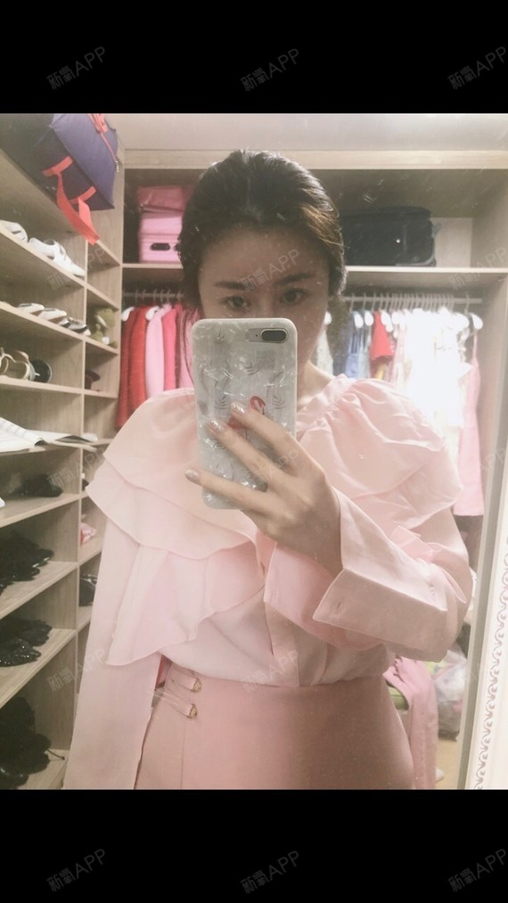 北京开外眼角好不好_效果图_丢丢圆滚滚开外眼角术后第124天_新氧美容