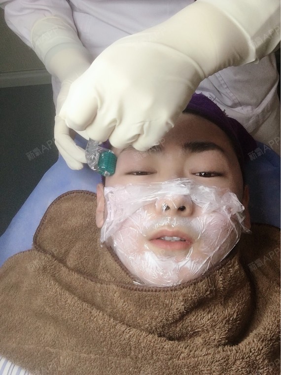 thlala黄金微针第1天美丽日记