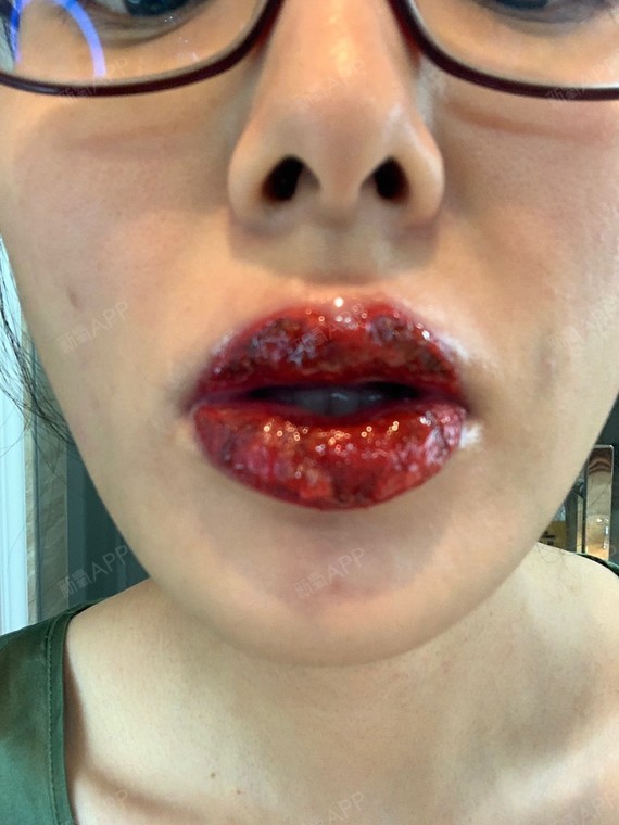 杭州半永久纹唇好不好_效果图_越爱越清楚半永久纹