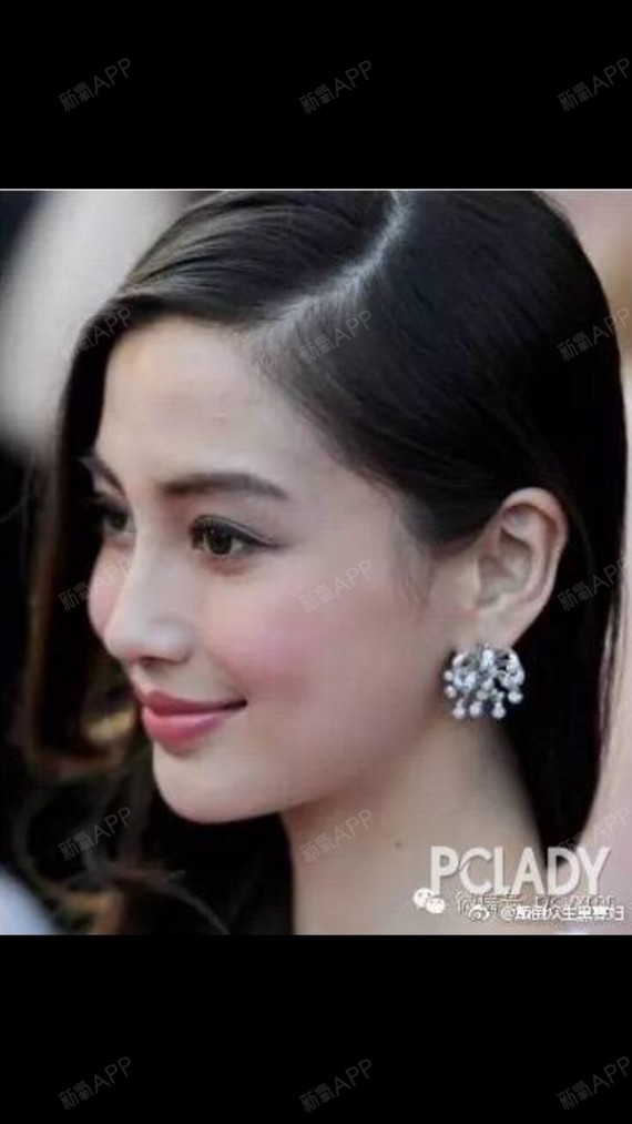 埋线人中,让我的嘴巴,变成了m,唇型好看了,侧面偏90度,省的做鼻子还要