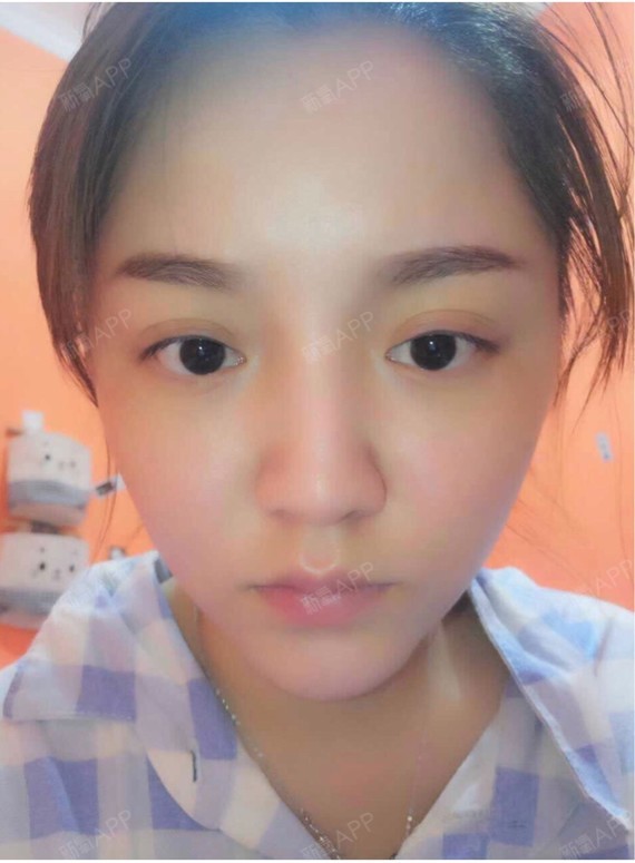 江澄南路18号恒大城玻尿酸丰泪沟好不好_效果图_氧气0b0i3玻尿酸丰