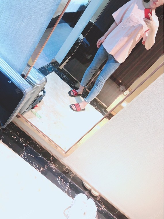 两个半月了,腿感觉应该差不多定型了,效果还算蛮满意_圈子-新氧美容