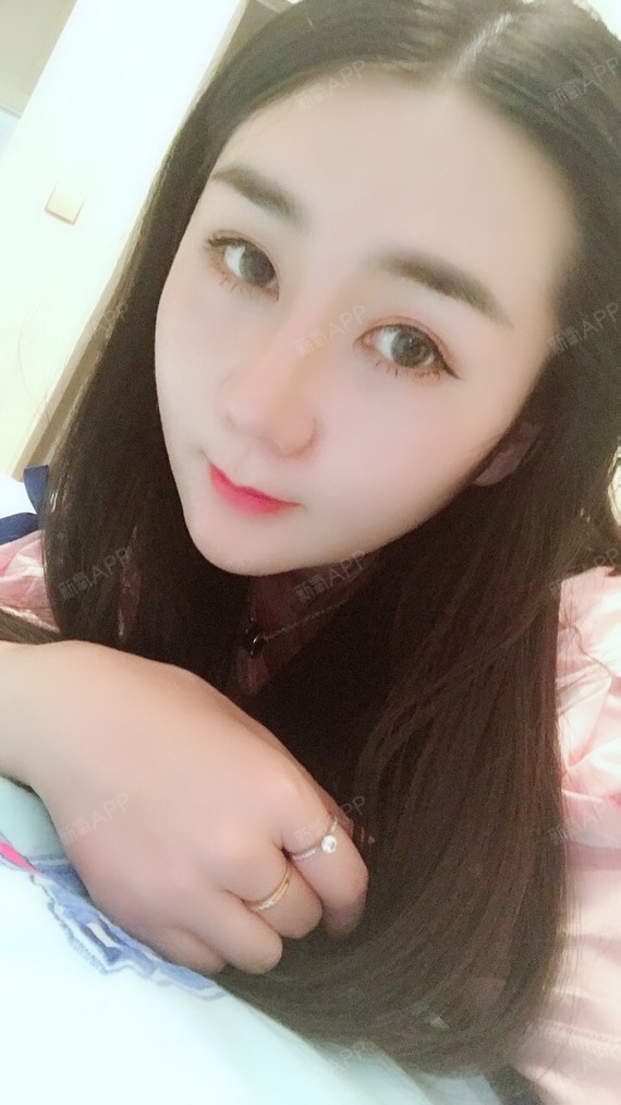 今天是手术第16天 感觉嘴边鼻翼边还是肿 笑也不能 圈子 新氧美容整形