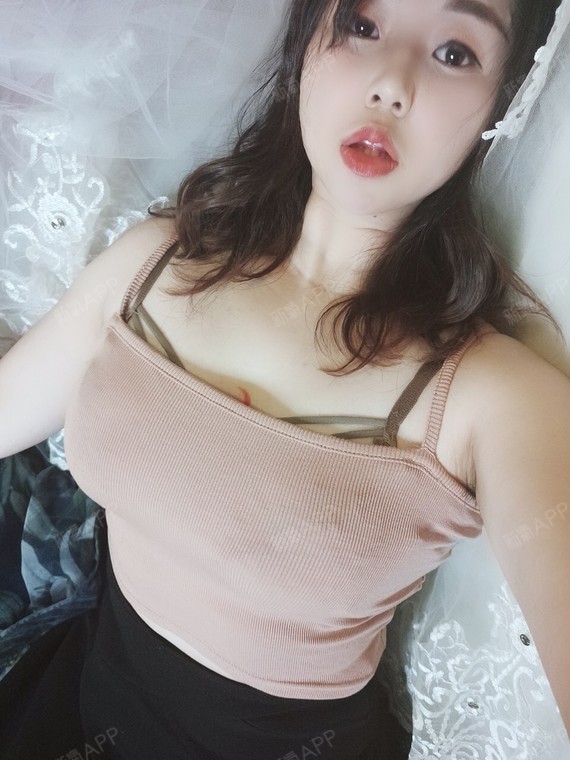 今天去医院拆线了,过程很顺利,自己的胸这么大还是有_圈子-新氧美容