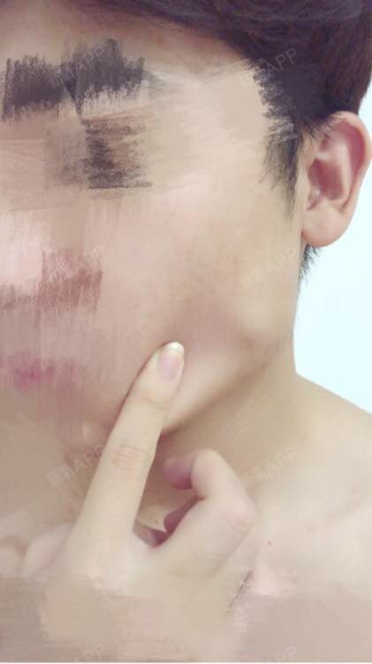 湖南男人最爱槟榔嚼的两个大腮帮子,亲妈都嫌我丑.