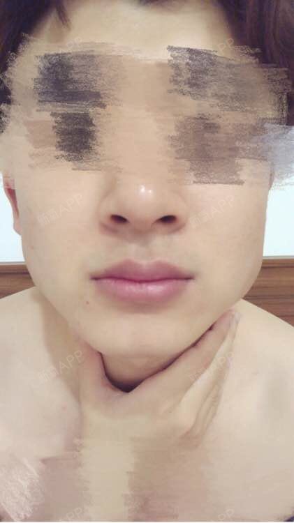 湖南男人最爱槟榔嚼的两个大腮帮子,亲妈都嫌我丑.