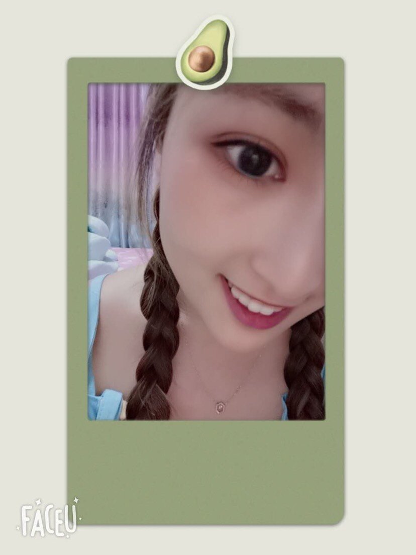 沈阳名流美容医院切开双眼皮怎么样_恢复过程_效果如何_卡哇咿233整形