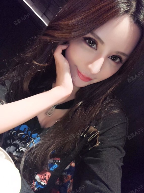 肋软骨隆鼻好不好_效果图_深圳雅美冯诗诗sisi肋软骨隆鼻术后第100天