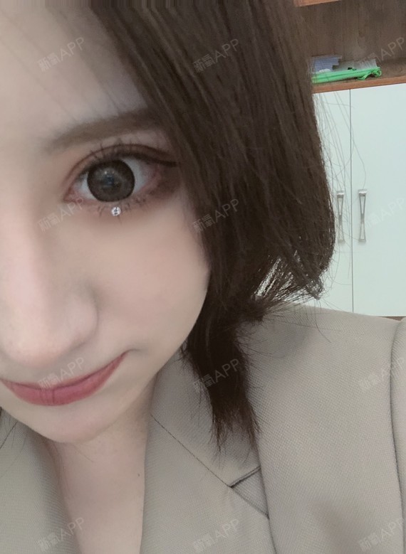 【元素美学贝赛尔双眼皮77筋膜下至】有姐妹问我下至的_圈子-新氧