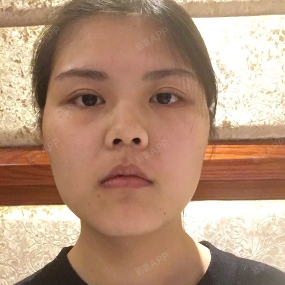 事实缺少美感的鼻子是女人的天敌