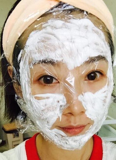 深圳伊肤泉微针好不好_效果图_西席子伊肤泉微针术后第1天_新氧美容