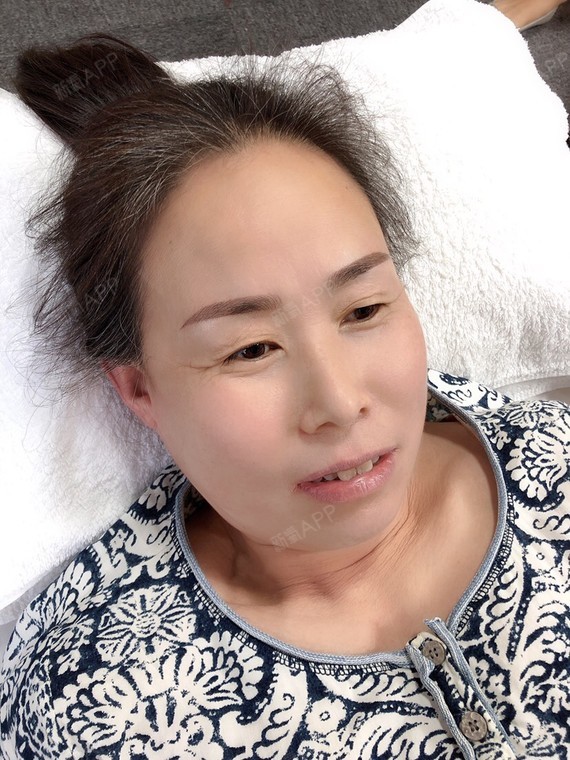 带着妈妈过来纹眉毛,之前做过有红底色选择了丝雾眉底_圈子-新氧美容