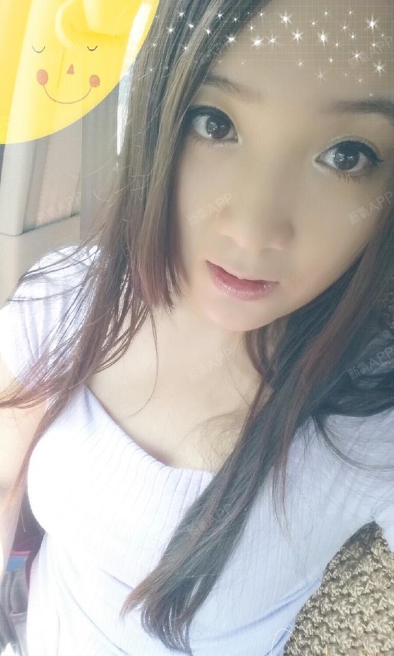 今天去做了漂红,乳晕一直就有点黑,可能是天生的黑色_圈子-新氧美容