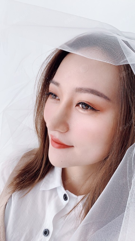 再来一波美美哒照片养养眼鼻子还会再自然一点的很多来_圈子-新氧美容