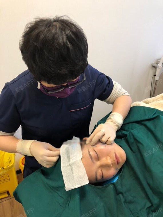 第一次来新氧分享线雕的过程,真的太后悔,纠结了这么久才来做线雕,不