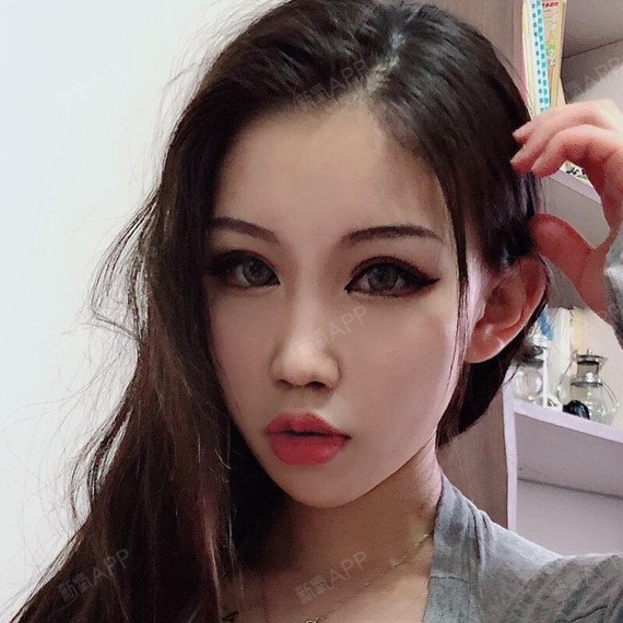 我的嘴唇比较薄,看上去也不好看,早就有了想丰唇的想_圈子-新氧美容