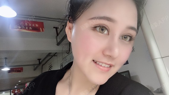 成都注射瘦脸好不好_效果图_氧气2kzw0注射瘦脸术后第1天_新氧美容