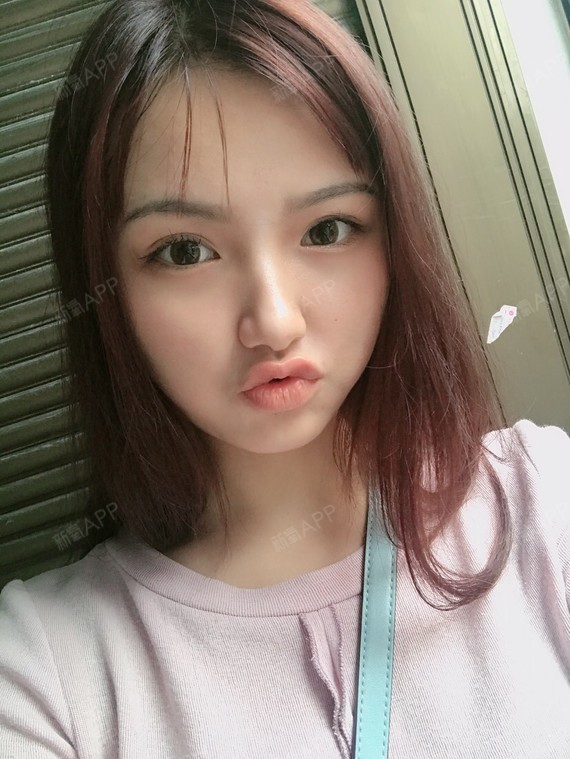 对于一个女孩子来说,面部的凹陷是一个很严重的问题啊_圈子-新氧美容