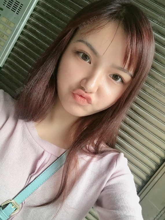 对于一个女孩子来说,面部的凹陷是一个很严重的问题啊_圈子-新氧美容
