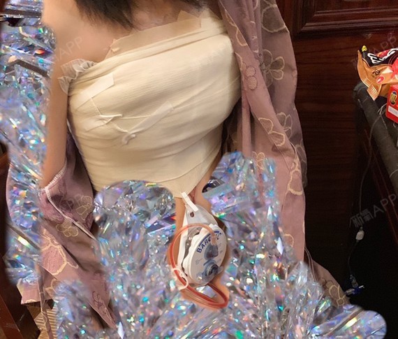 今天应该还不能去拆胸上的纱布 拆完纱布可以看到形状我会继续