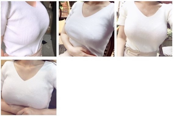 一直没胸,没胸一直是我_圈子-新氧美容整形