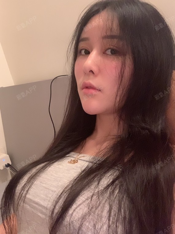 假体隆胸