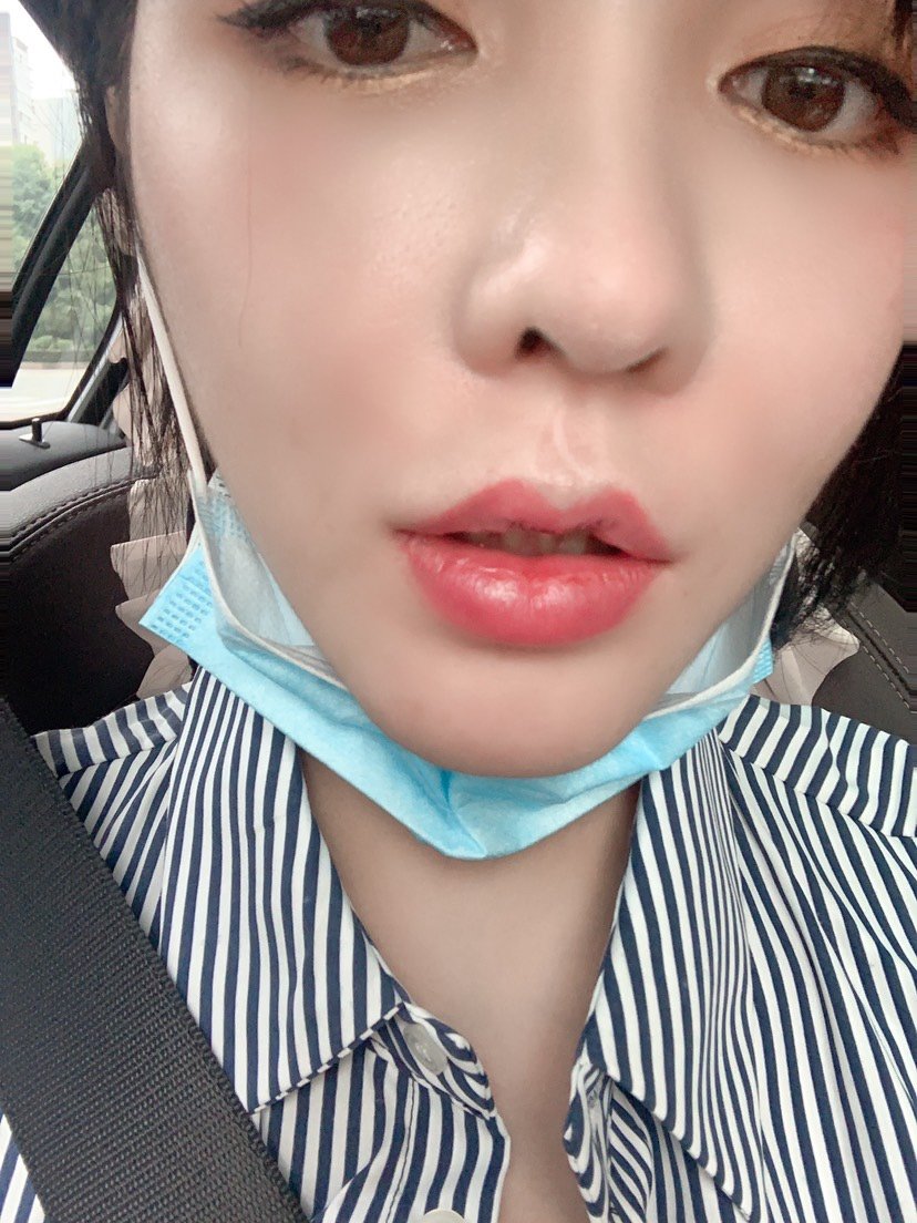 没有唇珠的平唇真的很减龄前提是要饱满