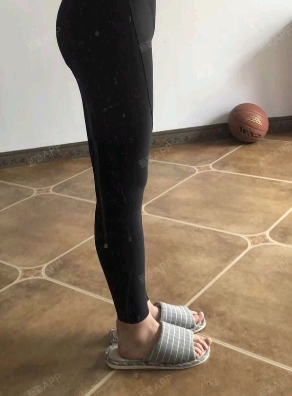 【青岛华颜美-黄金微雕瘦大小腿术后第9天】