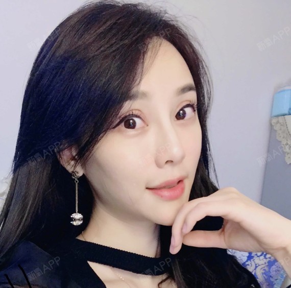 自体脂肪填充卧蚕