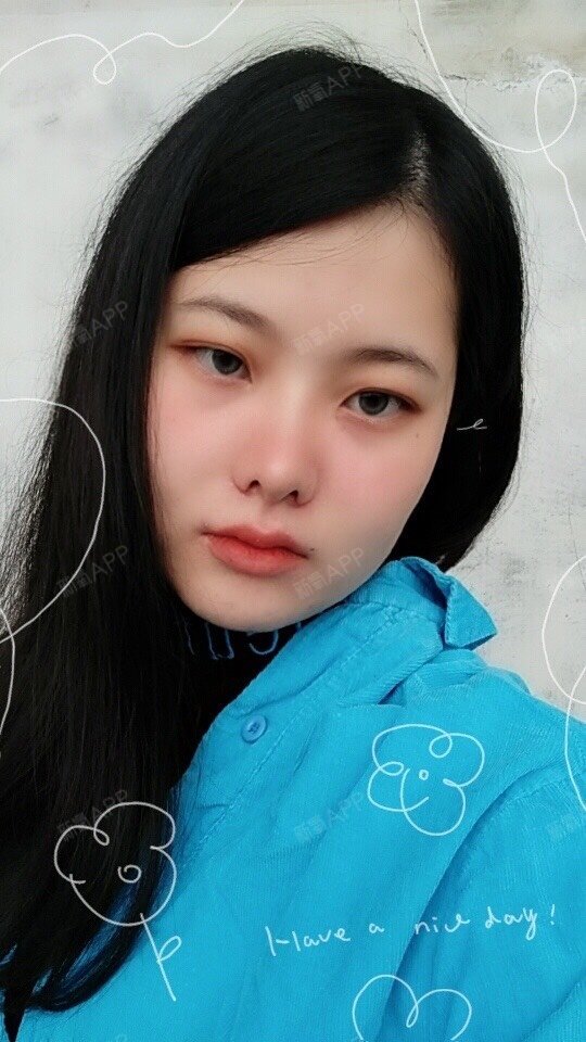 缩小鼻翼有风险么_鼻翼缩小钱_缩小鼻翼大概要多少钱