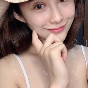 成都溶脂针瘦脸好不好_效果图_静小雨溶脂针瘦脸术后第65天_新氧美容