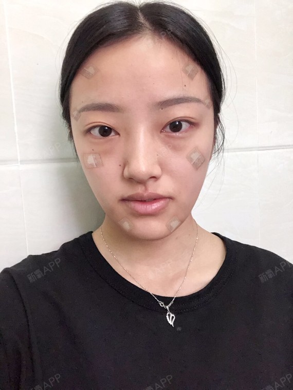 我是完全的干瘪瘪的脸,你们看出来了吗98.