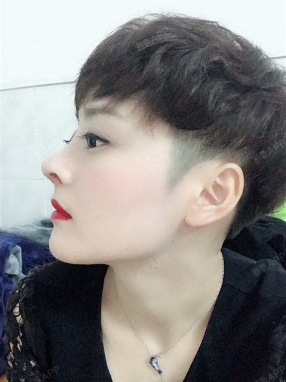 鼻子从侧面看真的非常立体,立体的鼻梁和微翘的鼻头形_圈子-新氧美容