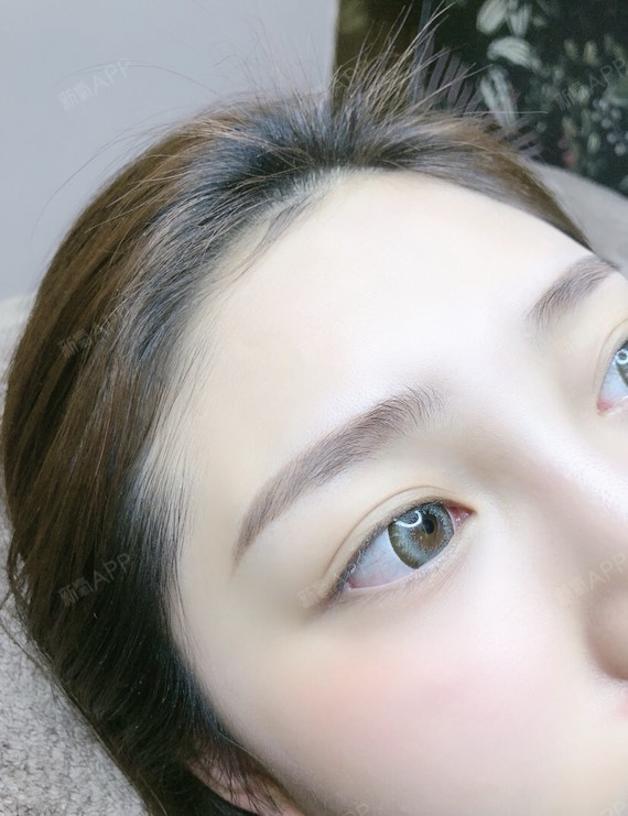 眉毛一直very淡,不好看,太惨了,不画眉毛真的超_圈子-新氧美容整形
