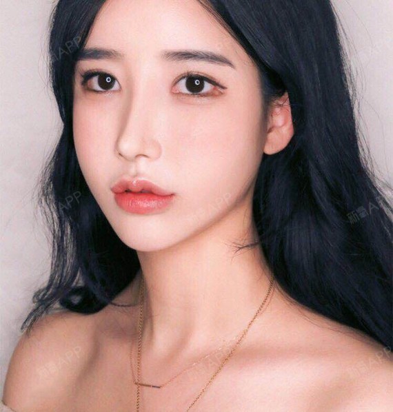 可以看的到脸部的状态很是比较饱满的状态,已经不肿了淤青也没有