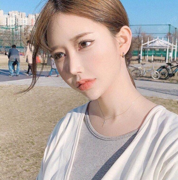 可以看的到脸部的状态很是比较饱满的状态,已经不肿了淤青也没有