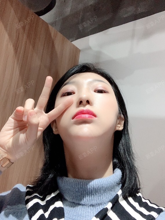 手术缩鼻翼好不好_效果图_氧气325w3手术缩鼻翼术后第44天_新氧美容