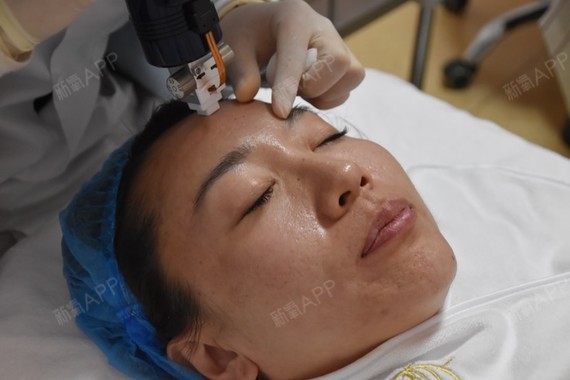 北京黄金微针好不好_效果图_天变美黄金微针术后第0天_新氧美容整形