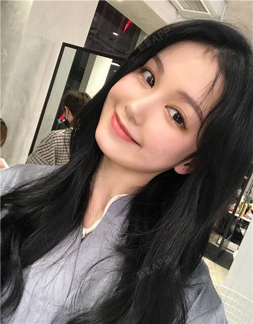 终于摆脱了m型下巴,感觉整个人都可以飞起来了,你们_圈子-新氧美容