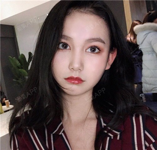 终于摆脱了m型下巴,感觉整个人都可以飞起来了,你们_圈子-新氧美容