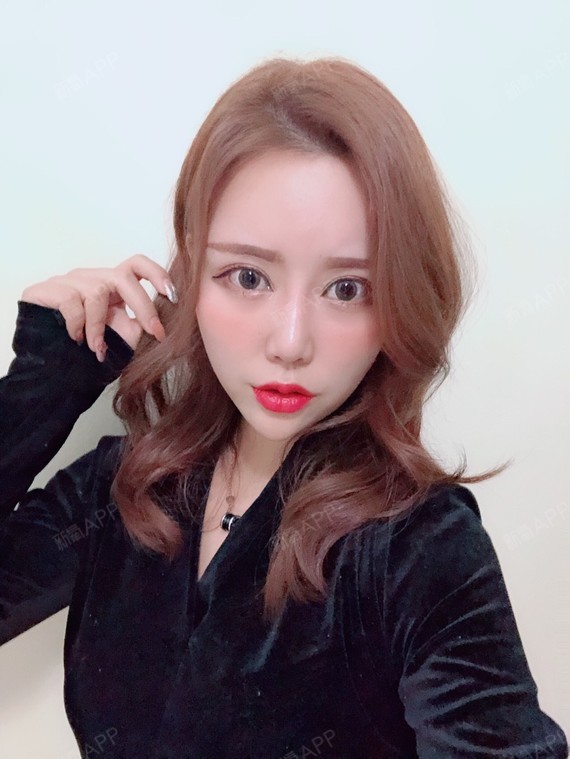 自体脂肪填充卧蚕